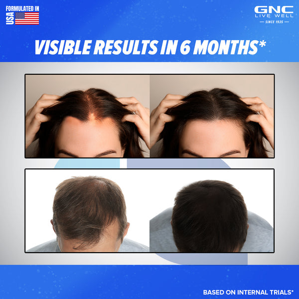 GNC Biotin+ Tablets Healthy Hair, Skin, and Nails- 30 TABLETS